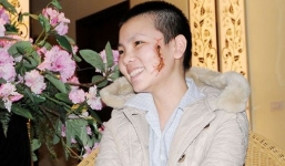 Cô gái bị ép cạo trọc đầu, mang hình xăm con rết trên mặt sau 8 năm giờ ra sao?