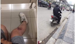 3 cô gái tố nam thanh niên Thanh Hóa cố tình gây tai nạn rồi sờ vùng kín