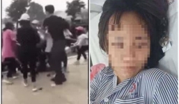 Quảng Ninh: Nữ sinh cấp 3 bị đánh hội đồng giữa quảng trường, chấn thương sọ não