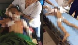 Nóng: Lại thêm một trường hợp bé trai 7 tuổi bị chó nhà cắn tử vong