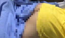 Bé trai lớp 4 bị bạn học nghịch ác lấy bút chì đâm xuyên thủng mông