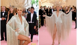 Bộ dạng khó tin của Celine Dion: thân hình gầy gò trong bộ váy dát vàng 10kg