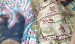 Hy hữu: Chồng vắng nhà đúng lúc nhà cháy, vợ cùng người đàn ông lạ mặt bị bỏng nặng