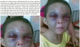 Thực hư thông tin bé trai ở Thanh Hóa bị dì ghẻ đánh đập tím mặt vì nhớ mẹ đẻ