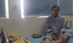 Hải Phòng: Phó Chủ tịch phường nghi đạp gãy chân một phụ nữ