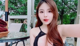 6 dấu hiệu ở lưỡi cảnh báo bệnh tật nhưng luôn bị coi nhẹ