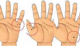 4 vị trí nốt ruồi trên bàn tay báo hiệu nhân duyên viên mãn, tình duyên 10 điểm