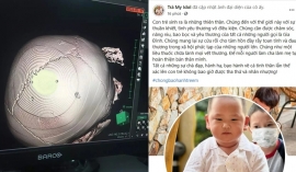 Hàng loạt sao Việt phẫn nộ vụ bé gái 3 tuổi bị đóng 9 cây đinh vào đầu