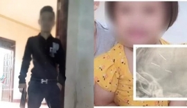 Vụ bé gái 3 tuổi bị đóng đinh: Xôn xao lời khai lan truyền trên mạng của nghi phạm