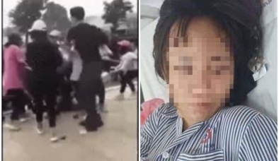 Quảng Ninh: Nữ sinh cấp 3 bị đánh hội đồng giữa quảng trường, chấn thương sọ não