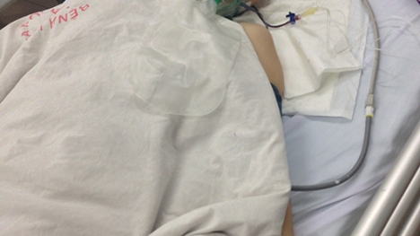 Con gái rủ cậu ruột vào BV cắt chân mẹ bị u não