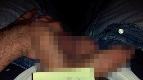 Người đàn ông có hai dương vật gây sốc cộng đồng mạng