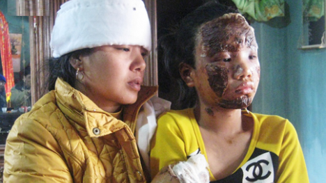 Khởi tố vụ quà sinh nhật phát nổ, 3 người thương vong