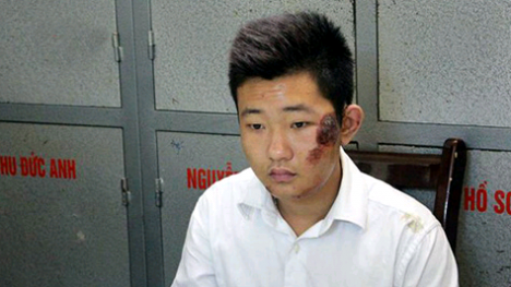 Bản tin 113 – chiều 2/4: Bảo vệ TMV Cát Tường thấy vết rạch trên xác chị Huyền…