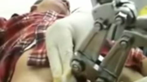 Mắc kẹt vì đeo nhẫn vào 'của quý' để cầu hôn bạn gái