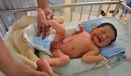 Bé sơ sinh bị bỏ rơi trong bụi tre, dòi trắng và kiến bu khắp người