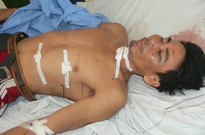 Đâm chết người tình rồi dùng kéo tự giết mình