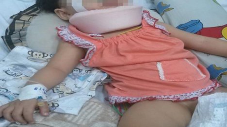 Bé 15 tháng tuổi chấn thương sọ não nghi cha hờ, mẹ ruột bạo hành