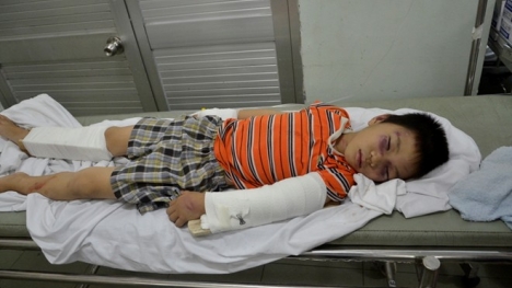 Bé trai 6 tuổi bị người tình của mẹ đánh gãy chân tay