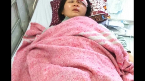 Tai nạn nghiêm trọng tại công trình đường sắt trên cao