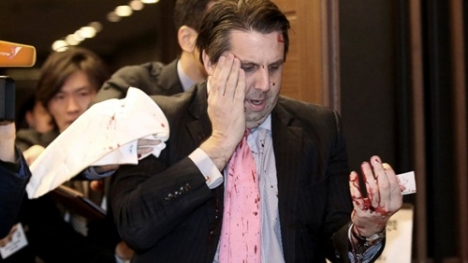 Triều Tiên ca ngợi vụ rạch mặt đại sứ Mỹ