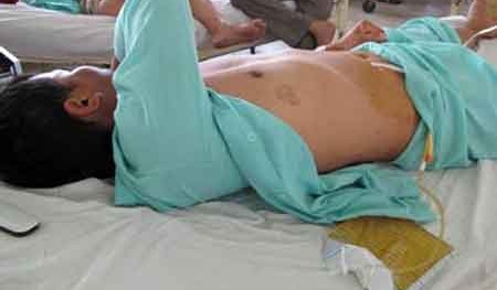 Vợ dùng dao cắt 'của quý' chồng vì nghi ngờ 'tòm tem' bên ngoài