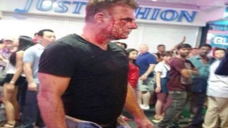 Ladyboy Thái Lan đánh du khách chảy máu vì 'chèo kéo' không thành