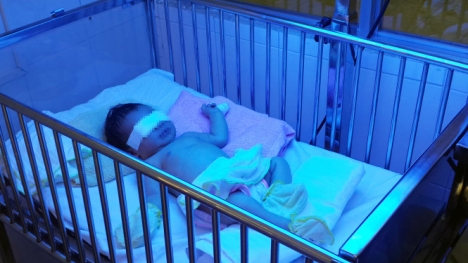 Bé sơ sinh bị mẹ cắn đứt ngón tay