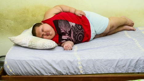 Hy hữu cậu bé 5 tuổi nặng hơn 80kg