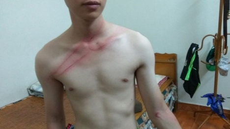 Nhân viên tố bị chủ tiệm sửa máy tính dùng dây điện vụt