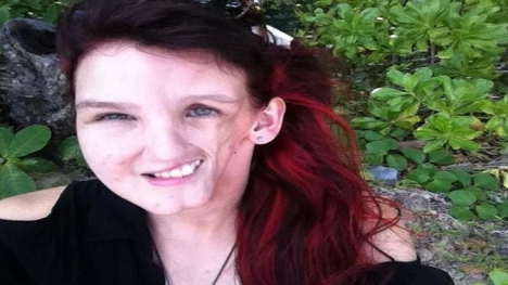 Cô gái xinh đẹp mắc chứng bệnh lạ khiến mặt trở nên méo mó