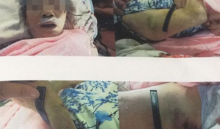 Con gái lặng người khi biết mẹ già 93 tuổi bị người giúp việc hành hạ dã man