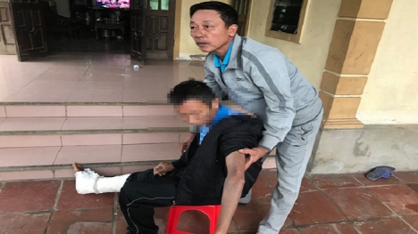 Bắt tạm giam con trai đánh bố bầm dập, gãy xương sườn ở Nghệ An