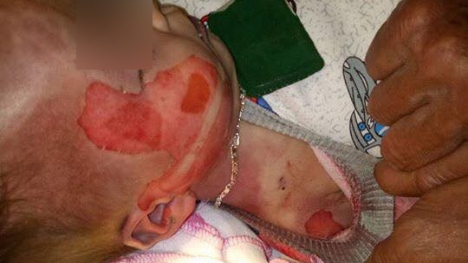 Bé trai tử vong trên người có nhiều vết thương lạ sau khi cấp cứu tại bệnh viện?