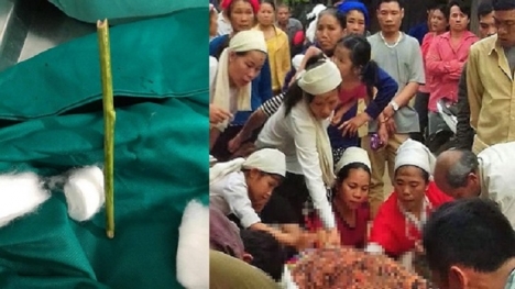 Bộ Y tế vào cuộc vụ sản phụ tử vong vì bị phá thai bằng que nứa