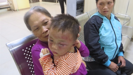 Tin tức mới nhất vụ bé trai 2 tuổi bị cha dượng bạo hành thâm tím mặt mũi