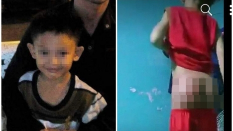 Vụ bé trai 8 tuổi nghi bị người tình của mẹ đánh đến chết: Nạn nhân từng bị bạo hành nhiều ngày trước đó