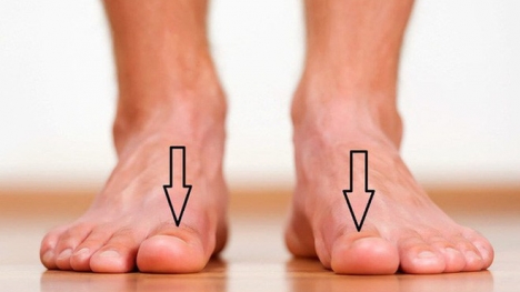 Bàn chân có 5 dấu hiệu này thì đừng chủ quan mà nên đi khám ngay