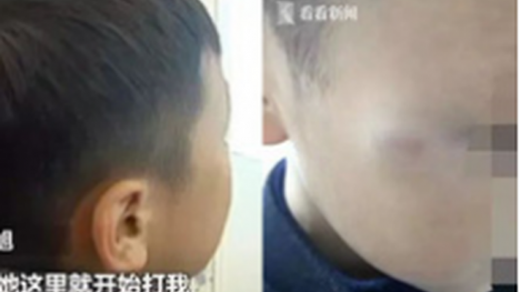 Cậu bé 7 tuổi bị cô giáo đánh vì sờ ngực, trong khi bố mẹ phẫn nộ thì phản ứng của cư dân mạng khiến ai cũng bất ngờ