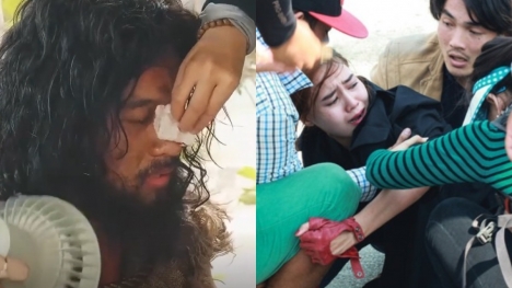 Sao Việt gặp tai nạn khi quay phim: Mai Tài Phến bị thương, Lan Ngọc bị móc vào bánh xe