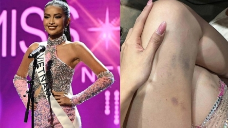 Ngọc Châu thẫn thờ khi trượt top 16, lộ đôi chân bầm tím ở Miss Universe 2022