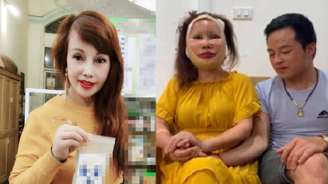 Cô dâu Thu Sao bất ngờ 'công phá' MXH với diện mạo mới, dân mạng xót xa vì phẫu thuật hỏng