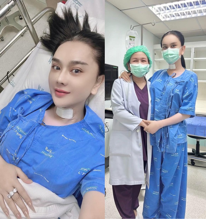 Lâm Khánh Chi cập nhật tình hình sức khỏe hậu phẫu, tiết lộ trường hợp xấu nhất - Ảnh 1 Lâm Khánh Chi cập nhật tình hình sức khỏe hậu phẫu, tiết lộ trường hợp xấu nhất - Ảnh 1