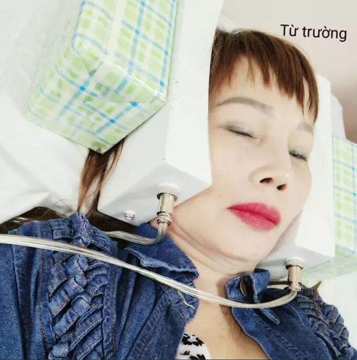 Cô dâu Thu Sao từng phải đi điều trị méo miệng