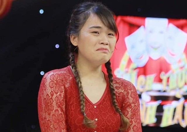 Diện mạo trước khi sửa mũi của 'thánh sún' Diện mạo trước khi sửa mũi của 'thánh sún'
