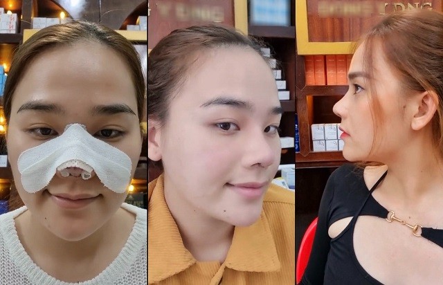 Hành trình thay đổi nhan sắc của Ngân Thảo Hành trình thay đổi nhan sắc của Ngân Thảo