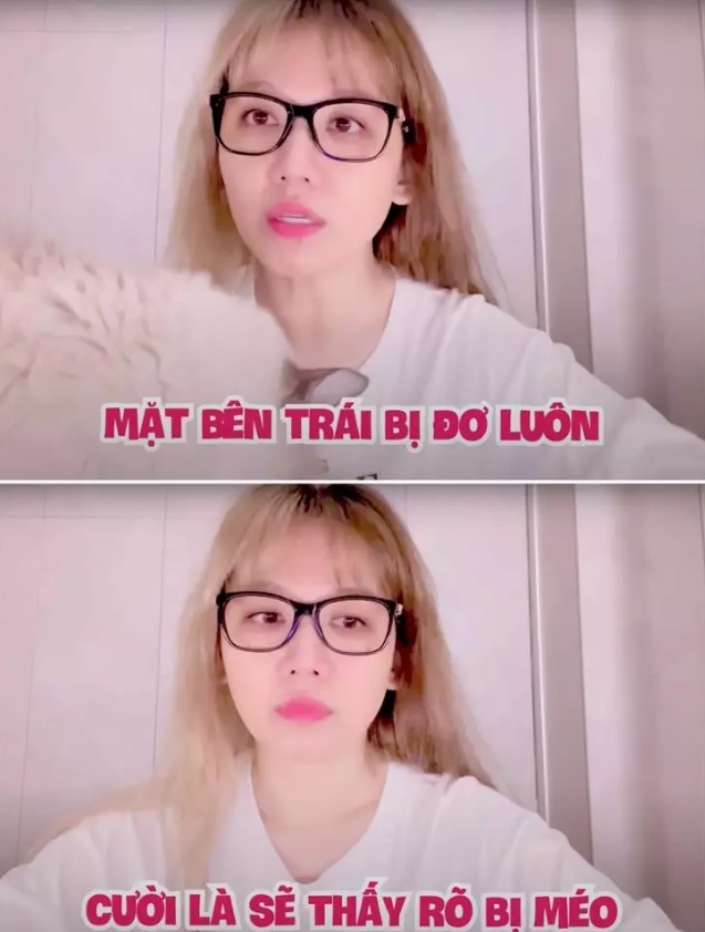 Hari Won cho biết bệnh tình sẽ khỏi sau vài tuần. Ảnh internet