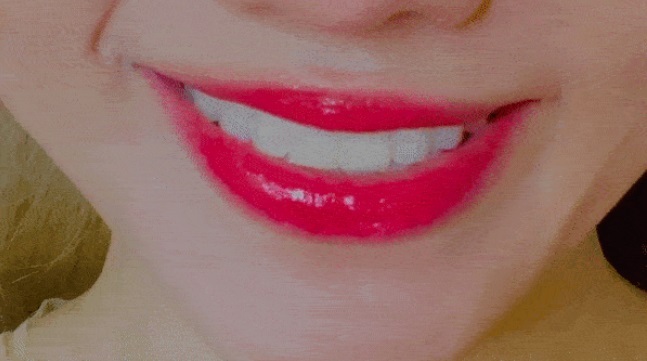 Khi cười miệng của Hari Won bị lệch sang một bên. Ảnh: FB