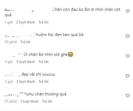 Khoe ảnh xinh đẹp, Thiên Ân khiến CDM xót xa khi lộ chân chằng chịt vết thương. Ảnh internet Khoe ảnh xinh đẹp, Thiên Ân khiến CDM xót xa khi lộ chân chằng chịt vết thương. Ảnh internet