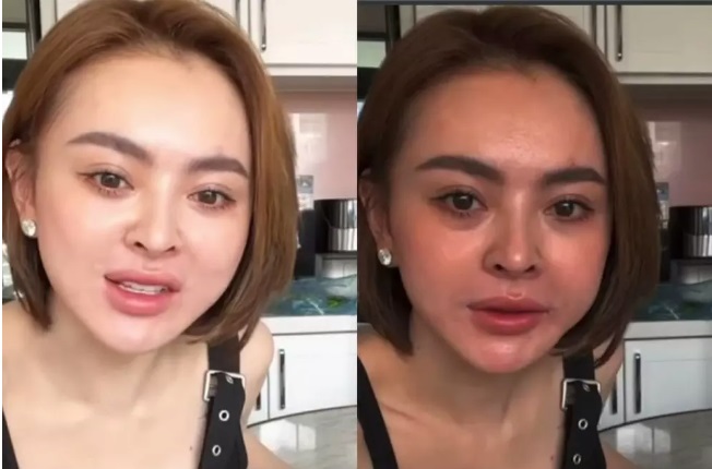 Làn da không đều màu khiến Trang Nemo kém sắc hơn so với ảnh qua chỉnh sửa. Ảnh internet Làn da không đều màu khiến Trang Nemo kém sắc hơn so với ảnh qua chỉnh sửa. Ảnh internet